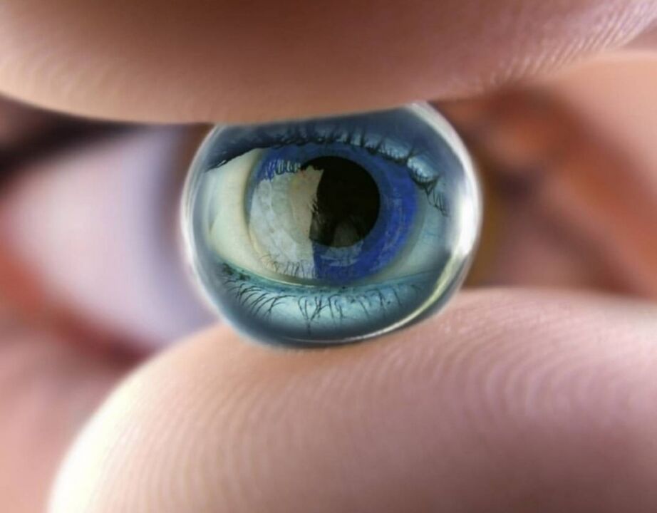 Les lentilles de nuit orthokératologiques stoppent la progression de la déficience visuelle